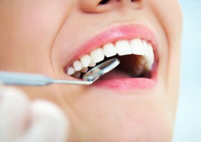 Profilaktyka stomatologiczna Sopot - AS dent Klinika